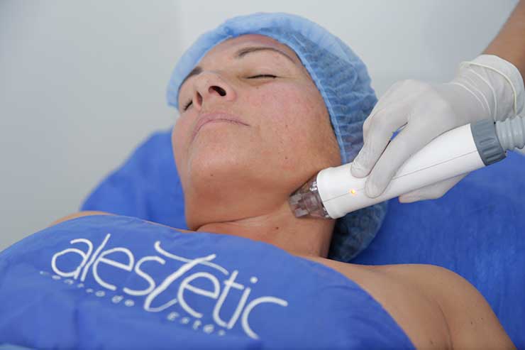 NShapefacial_06A5339